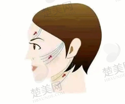 五、深圳今喜医疗美容的术后护理