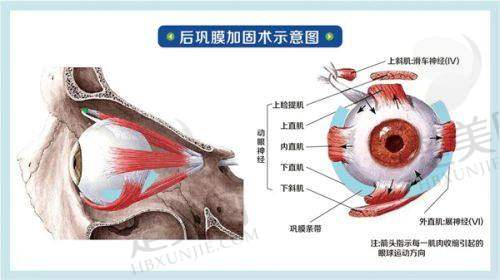 一、宜昌西泠爱尔眼科医院