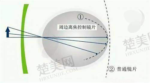 四、武汉佰视佳眼科医院实力大揭秘