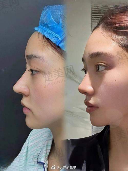 七、叶海洲真实的患者评价