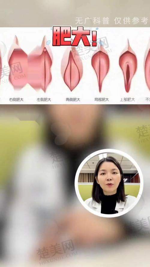 六、深圳米兰柏羽医疗美容医院：私密飘红与缩阴之选