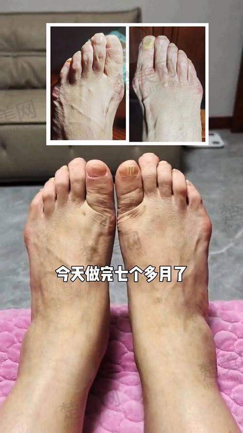 三、海淀大姨亲历：找苏医生看诊全流程