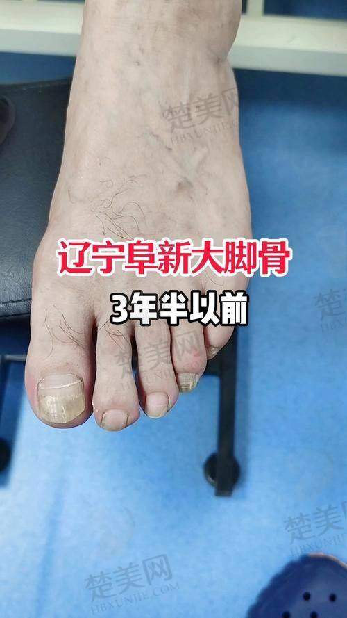 四、术后天就逛街？真相来了