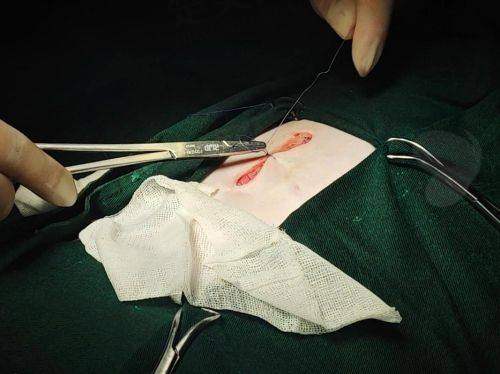 二、医生建议：不良饮食习惯引发的肿胀不消