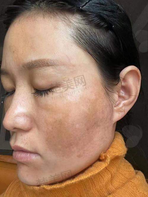 六、南阳艾美医疗美容门诊部——连锁机构有保护