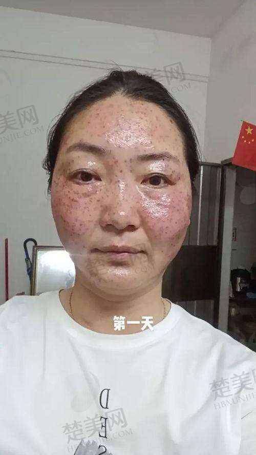 五、南阳市中心医院整形美容科——技术攀升