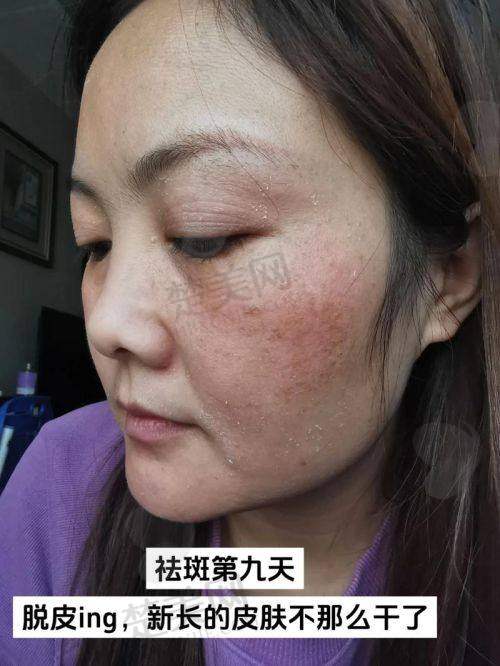 八、南阳天后医疗美容门诊部——设备与技术兼备