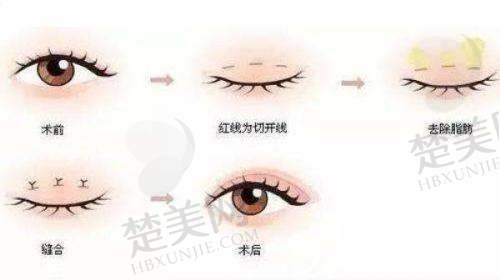 八、总结：选择胡小清医生，开启美丽新征程