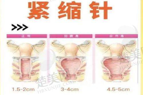 一、深圳陈群医生简介