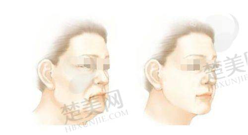 六、辽宁曙光整形外科医院正规性之价格与透明度
