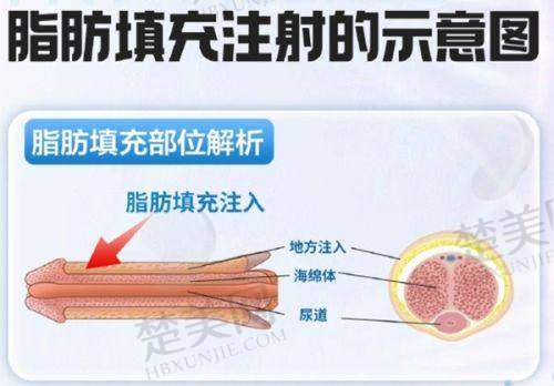 五、总结：成都李建刚医生技术与满意度双在线，值得信赖