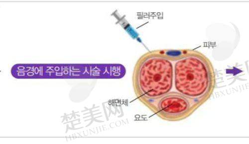五、成都素美整形美容医院做筋膜提升:服务与口碑