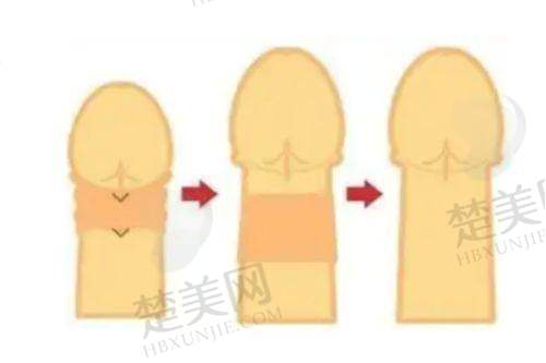 二、廊坊艾美皮肤激光整形医疗美容：科技与美学的理想结合