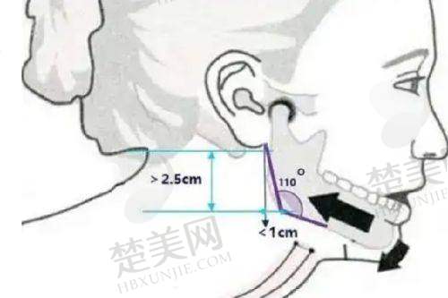 三、沈阳杏林胸部整形医院价格范围