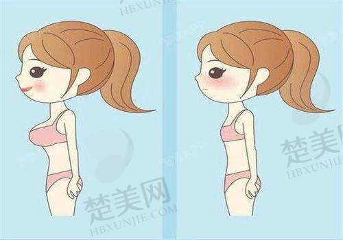 二、成都素美整形美容医院做筋膜提升:筋膜提升技术解析