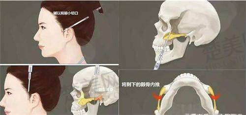 二、吕春龙吸脂价格:明码标价特别正规