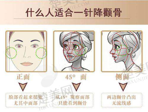 一、泉州海峡医疗美容医院：老牌连锁的整形实力派