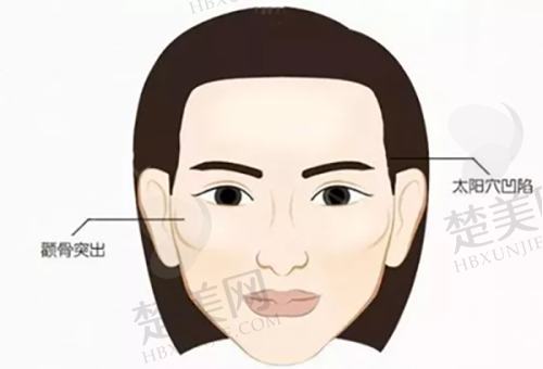 三、佀同帅全切双眼皮技术优势