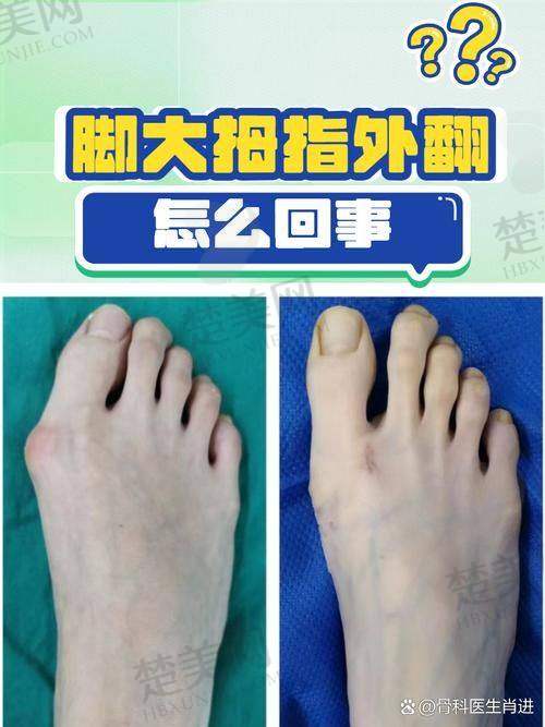 四、北京伊美尔医疗美容医院——美容矫正理想融合