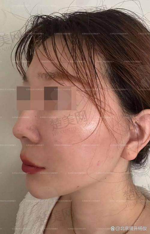 七、成都无痕筋膜手术价格影响因素及避坑指南
