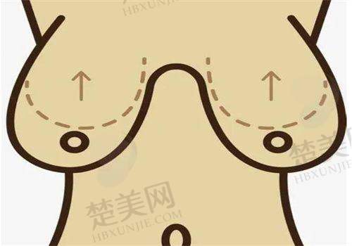 二、成都八大处眼部整形项目及价格