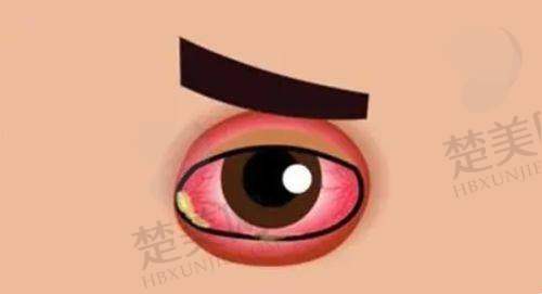 一、吉大二院眼科放号时间