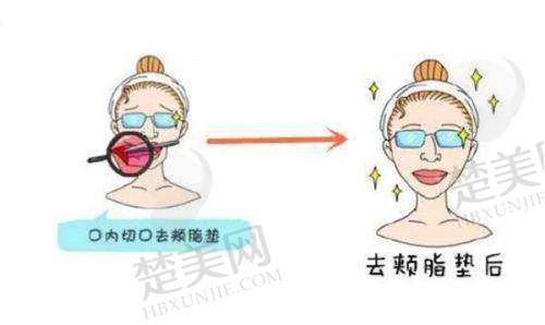 十、济南星缘达医疗美容整形医院——口碑良好,特色手术受关注