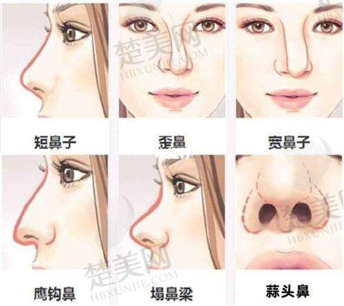 三、深圳整形美容医院收费参考