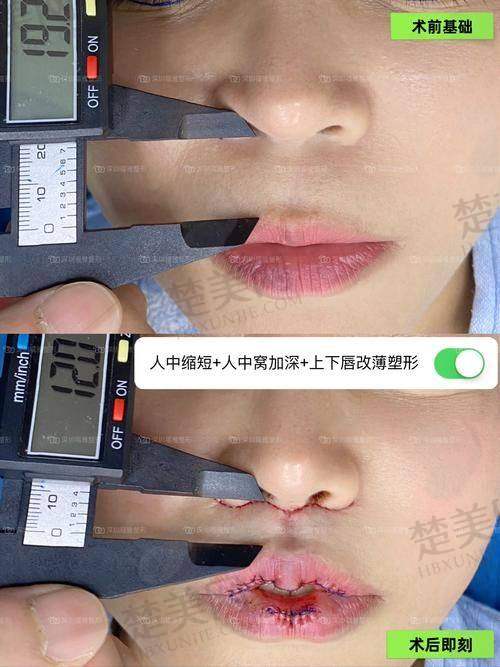 七、宫国华医生——北京宫国华医疗美容诊所
