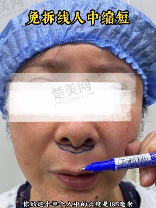 八、朱石江医生——沈阳杏林整形外科医院