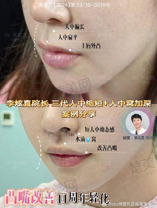 六、手术成效与风险