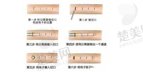 （三）武汉艺星整形医院——武汉轮廓固定注射正规医院