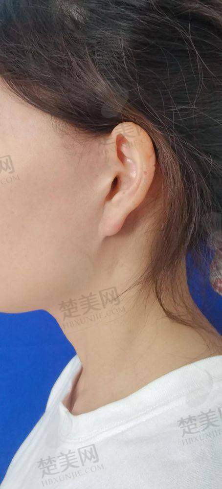 二、成都初龄整形蒲兴旺医生