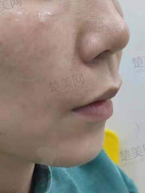 四、王晓健人中缩短术的价格情况