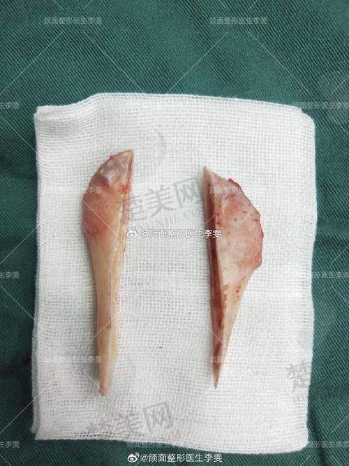 七、总结