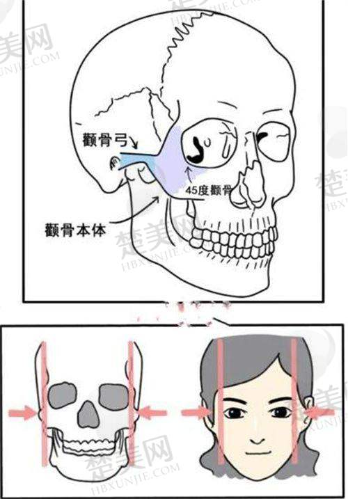 四、隆胸项目价格及技术优势
