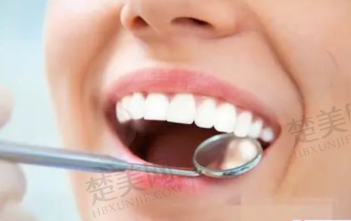 三、深圳贝博口腔门诊部诊疗项目有哪些?