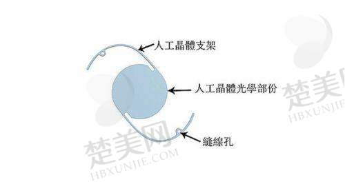四、武汉美基元整形医院隆鼻手术成效大揭秘