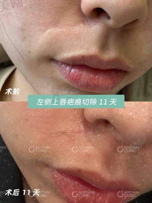 四、沈阳华美疤痕医院的口碑情况