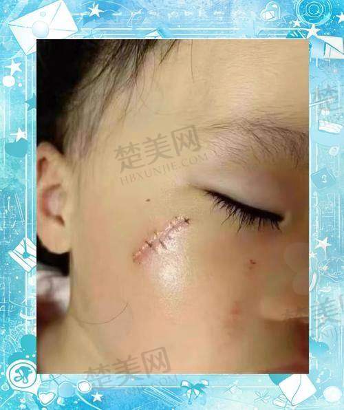 三、沈阳华美疤痕医院的服务质量