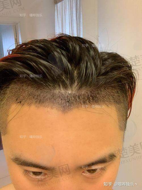 八、天津熙朵医疗美容门诊部预约方式