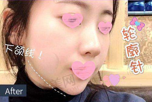 八、合肥东方怡人医疗美容门诊部预约方式