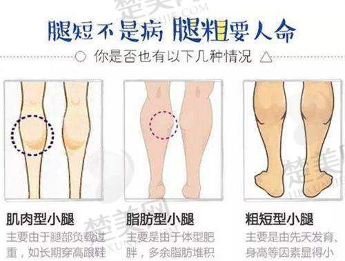 七、徐州方华时代美容医院预约方式