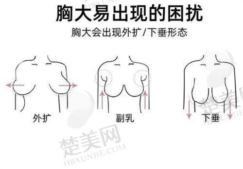 专精团队