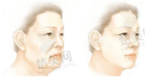 萍乡优美整形医院2025年价格表相关说明