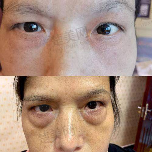 九、厦门医疗美容医院：认证批准技术出色