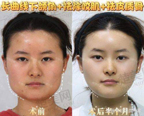 三、南通康美美容医院医生刘洋擅长项目