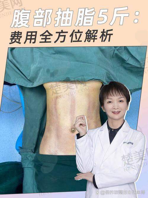 四、患者真实实例与口碑反馈