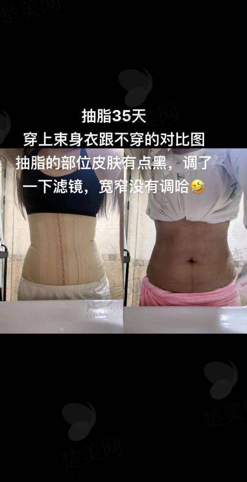 三、选择哈尔滨羽禅医美的原因