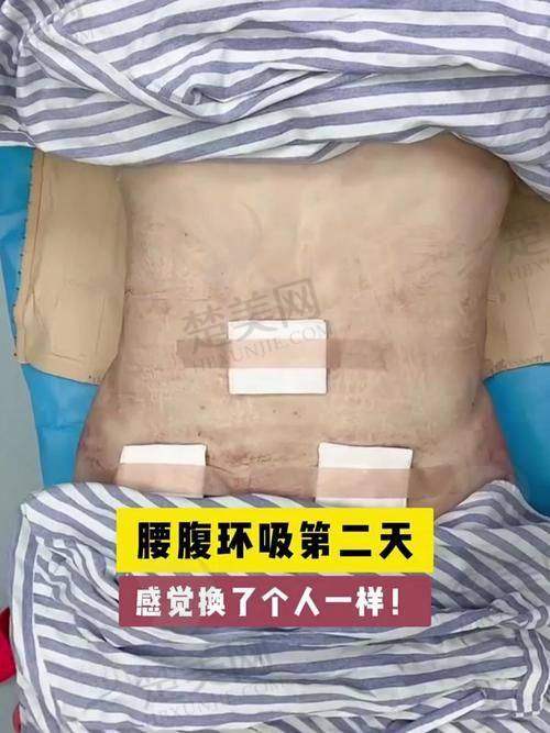 一、哈尔滨羽禅医美杨宇梓医生简介